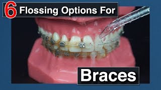 How to Floss with Braces [upl. by Briant]