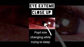 eye anatomy  pupil size changing while trying to sleep  miosis [upl. by Yttak21]