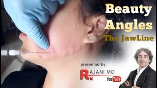 How to Create Beauty Angles  Filler Injections Jawline Rajawline Portland Oregon [upl. by Vergne]