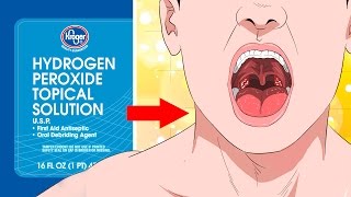 10 Surprising Uses For Hydrogen Peroxide YOU NEED TO KNOW [upl. by Sorenson393]