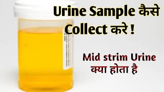 mid stream urine collection procedure II urine specimen collection procedure [upl. by Lamrert]