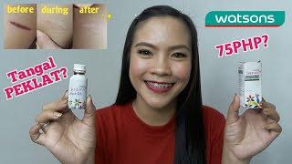 SKINMATE Shark Oil REVIEW as SCAR REMOVER [upl. by Arodal136]