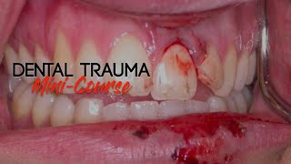 Dental Trauma MiniCourse  Part 3  Dental Trauma Guide  Introduction [upl. by Nairdna]