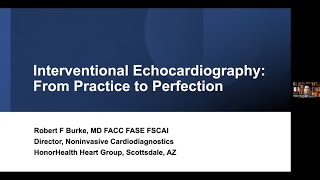 Interventional Echocardiography From Practice to Perfection [upl. by Aicertal]