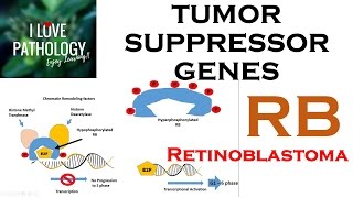 NEOPLASIA 3 TUMOR SUPPRESSOR GENES Retinoblastoma Gene Knudsons Two Hit Hypothesis [upl. by Nylekcaj891]