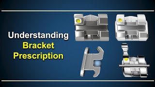 Understanding Bracket Prescription [upl. by Molton]