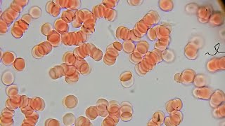 Blood and Blood Types  Under The Microscope [upl. by Mitchael221]