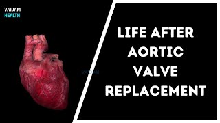 Open Aortic Aneurysm Repair [upl. by Jarvis]