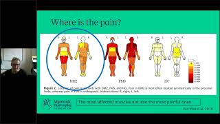 AsktheExpert Myotonic Dystrophy Type 2 amp Pain Management [upl. by Greenlee]