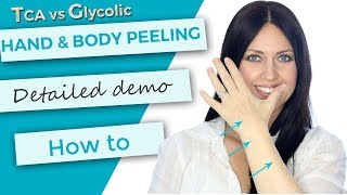 Hand and Body Peeling  Tutorial  Demonstration  TCA 30 versus Glycolic 70 [upl. by Zetta]