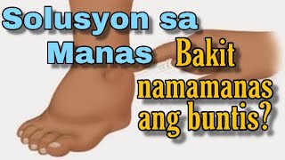 Bakit Namamanas ang Buntis  SOLUSYON Para sa Manas [upl. by Russel]