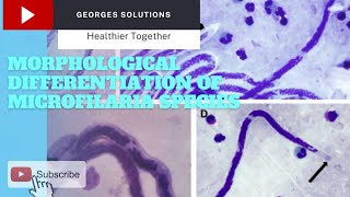 Morphological Differentiation of Microfilaria species [upl. by Joyan]
