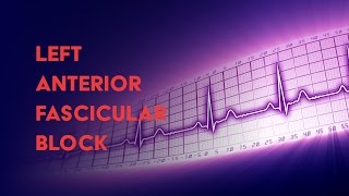 Left Anterior Fascicular Block  How to Read an Electrocardiogram EKG  MEDZCOOL [upl. by Nimsay]