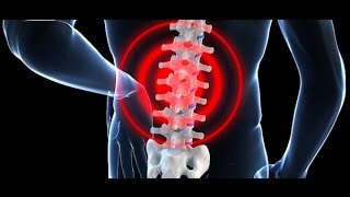 Video Explanation What is Low Back Pain [upl. by Joyann]