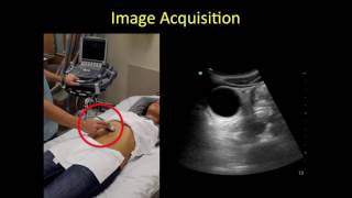 Gallbladder point of care ultrasound tutorial [upl. by Andy39]