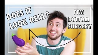 FTM BOTTOM SURGERY  Your Questions Answered [upl. by Ecyac]