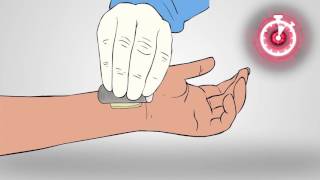 Axiostat  Vascular Haemostatic Dressing  How to use [upl. by Assiran979]