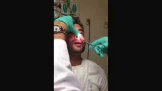 Part 2Nasal Splint Removal quotPULLING OUT WORLDS BIGGEST BOOGERquot WARNING NOT FOR THE SQUEEMISH [upl. by Ahtelat801]