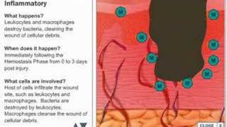 Wound Healing Process [upl. by Torey]