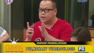 3 Signs of Pulmonary Tuberculosis [upl. by Goddord]