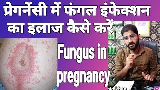 प्रेगनेंसी में फंगल इन्फेक्शन का इलाज कैसे करें।How to treat fungus in pregnancy by ammar rashid kha [upl. by Monda616]