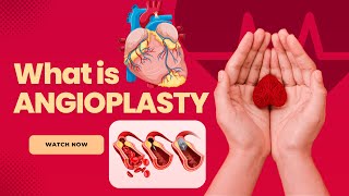 What is Angioplasty  Understanding the LifeSaving Heart Procedure [upl. by Bik]