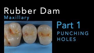 Rubber Dam Isolation Part 1 Punching Maxillary Holes [upl. by Francesco328]