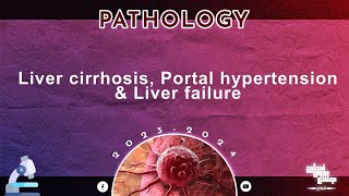 L2 Liver cirrhosis Portal hypertension and Liver failure Pathology [upl. by Joell966]