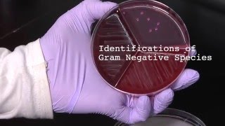 10 How to Identify Gram Negative Species [upl. by Letnohc]