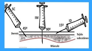 INYECCIÓN SUBCUTÁNEA EN BRAZO 💉💉 [upl. by Assirod]