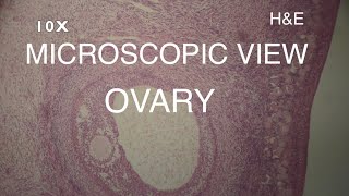 MICROSCOPIC VIEW OVARY [upl. by Hunt]