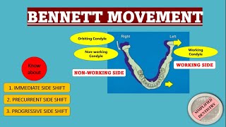 Bennett Movement and Its Classification  Bennett Angle [upl. by Elleinahc]