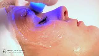 Exilis Ultra 360º  Aparatologia Facial [upl. by Zsolway]