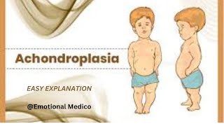 Achondroplasia  Bone pathology  emotionalmedico [upl. by Esiuolyram]