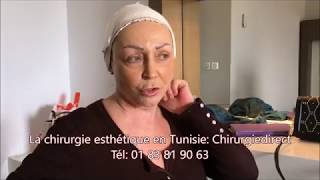 Chirurgie esthetique Tunisie lifting cervico facial à 66 ans [upl. by Hadik]