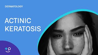 Living with Actinic Keratosis  Carolines Story [upl. by Soalokin]