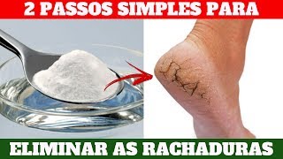 Como Tirar Rachadura dos Pés Com 2 PASSOS SIMPLES  GARANTIDO Remédio Para Rachadura no Pé  2019 [upl. by Slayton]