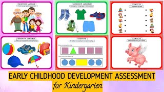 ECD ASSESSMENT FOR KINDERGARTEN  EARLY CHILDHOOD DEVELOPMENT ASSESSMENT [upl. by Rheingold]