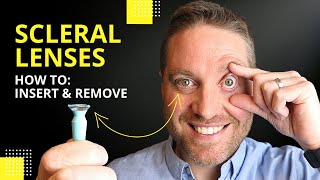 Scleral Lenses Insertion And Removal Plus Pro Tips For Beginners [upl. by Letnuahs]