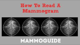 How To Read A Mammogram [upl. by Akimrej]