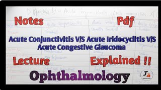 Difference between Acute Conjunctivitis Acute Iridocyclitis and Acute Congestive Glaucoma [upl. by Tibbetts]