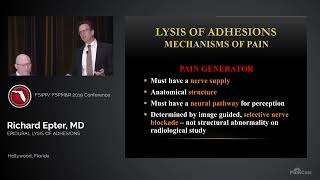 Dr Richard Epter Epidurolysis of Adhesions [upl. by Torbart638]