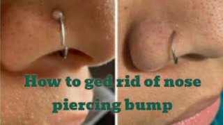 How to get rid of nose piercing bump getting a nose or ear piercing piercing bump nose piercing✨🥀 [upl. by Yup898]