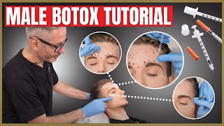 Botox Tutorial For Men  Botox Injection Patterns  Forehead Corrugators amp Crows Feet [upl. by Gustaf]