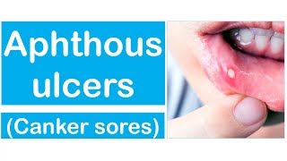 Aphthous Ulcers  Fully Explained Video Tutorial [upl. by Sivart]