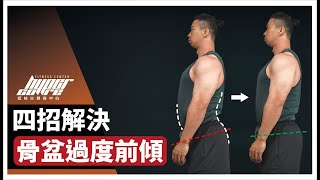 跟下背痠痛說掰掰，4 招解決骨盆過度前傾｜死蟲、鳥狗、棒式、核心運動 ft Mike 教練 [upl. by Juliette110]