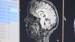 Preventing Brain Injuries  Cincinnati Childrens [upl. by Lovmilla612]