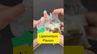 Ligamentum Flavum Modelling  Dynamic Disc Designs [upl. by Espy896]