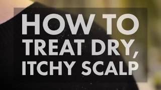 How to Treat a Dry Itchy Scalp  WebMD [upl. by Ailuy382]