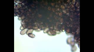 Psilocybe cubensis Spores under Microscope [upl. by Caty]